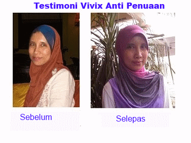 testimoni-vivix-shaklee-anti-penuaan-anti-aging